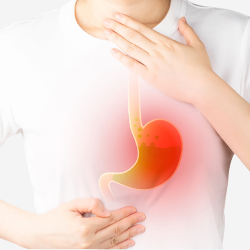 Acid Reflux