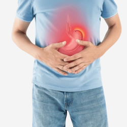 Stomach Ulcers