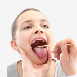 Tonsillitis