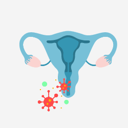 Vaginal Infections
