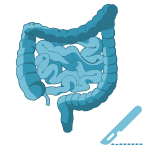Colorectal Surgeon (የአንጀትና ፊንጢጣ ቀዶ ህክምና ሰብ ስፔሻሊስት)